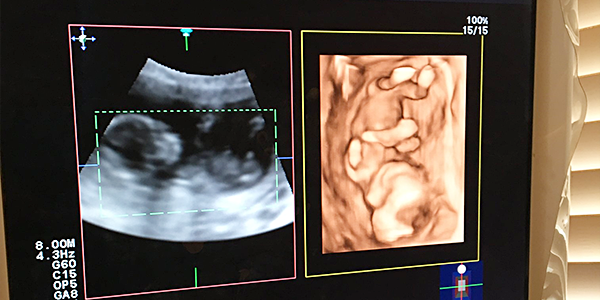 分娩のご予約・助産院で妊婦健診の開始